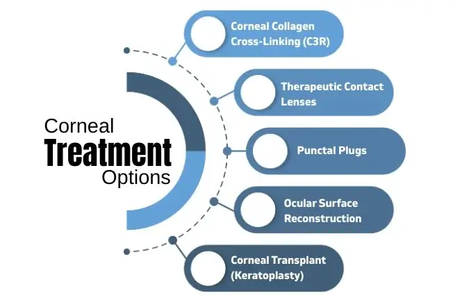 Cornea treatment options