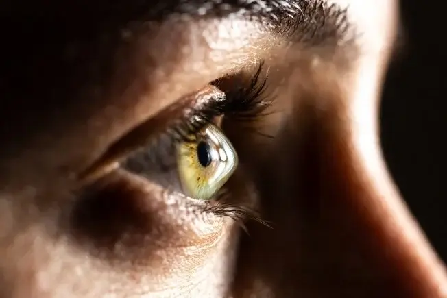 Keratoconus eye problem