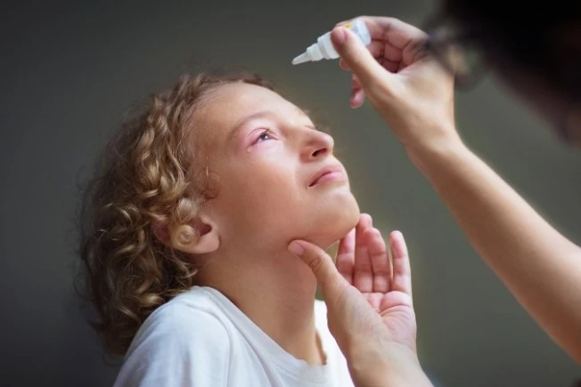 Eye Flu in Children