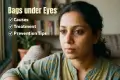 Bags Under Eyes