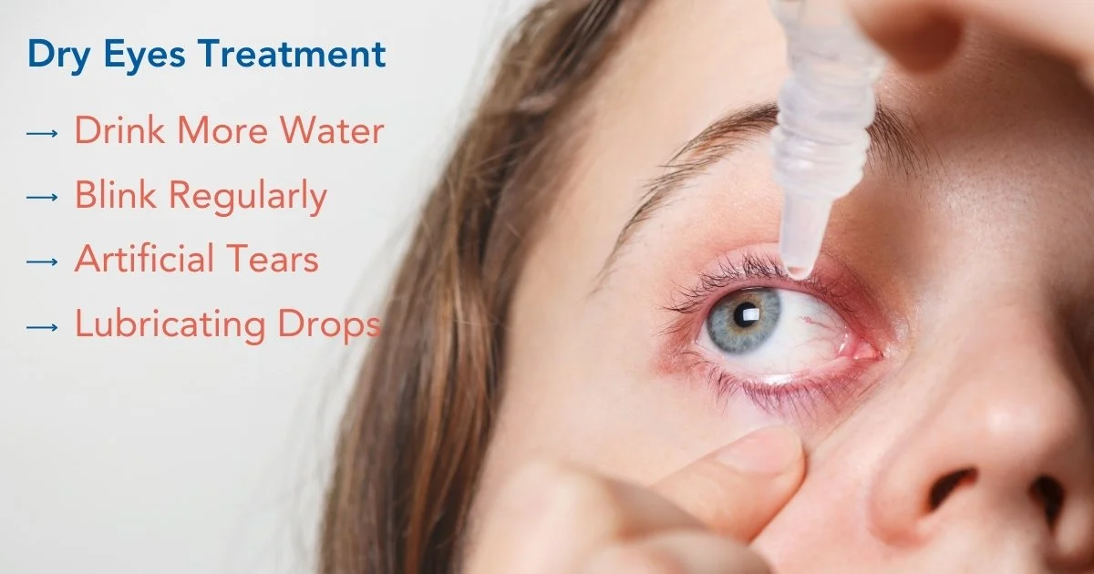 Effective Dry Eyes Treatment Options