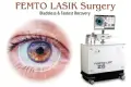 Femto lasik surgery