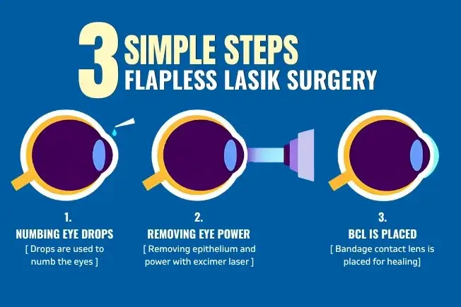 What is flapless lasik