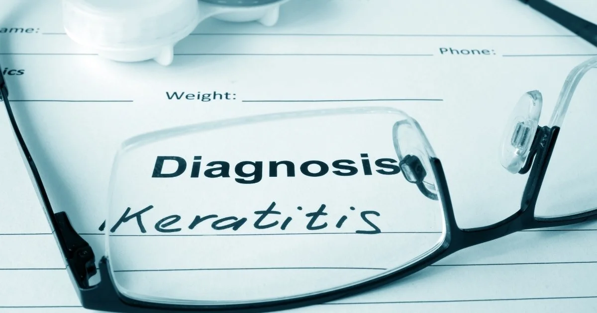 Diagnosing Keratitis
