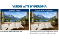 Vision With Hyperopia Or Farsightedness