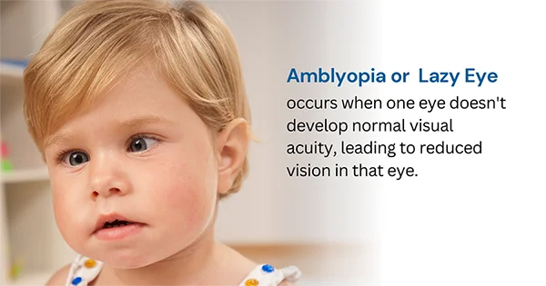 Get Lazy Eye (Amblyopia) Treatment for Kids and Adults