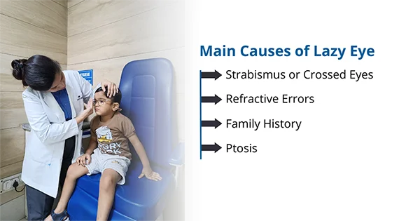 Understanding the Causes of Lazy Eye