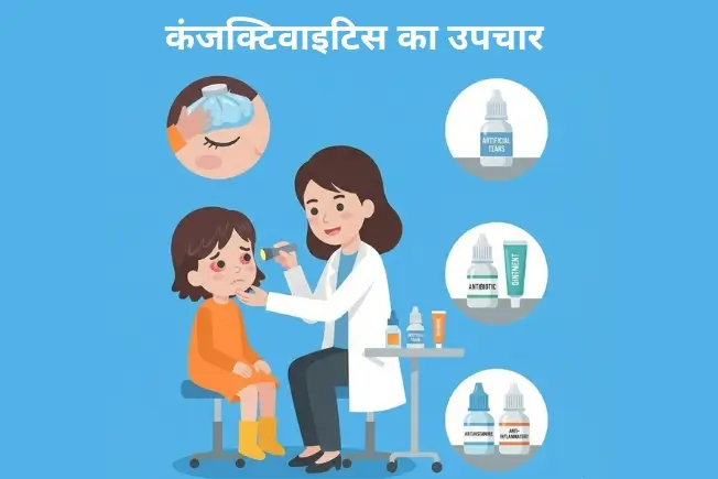 कंजक्टिवाइटिस का उपचार