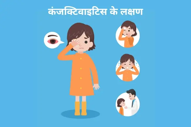 कंजक्टिवाइटिस के लक्षण