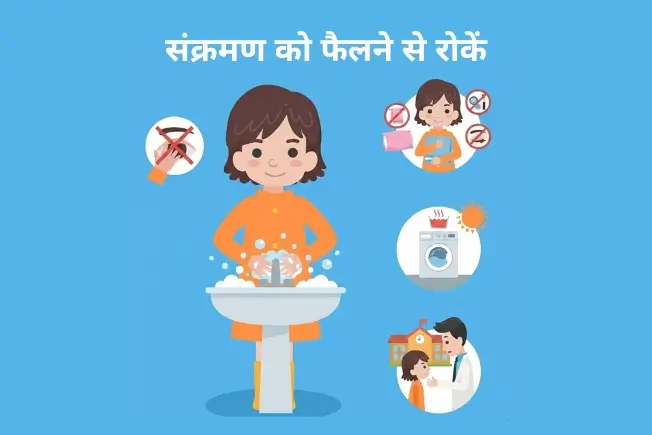 संक्रमण को फैलने से रोकें