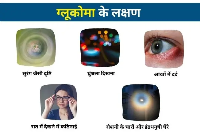 ग्लूकोमा के लक्षण