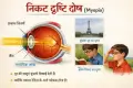 निकट दृष्टि दोष