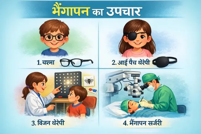 भैंगापन का उपचार