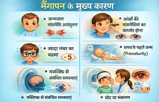 भैंगापन के मुख्य कारण