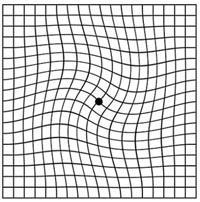 Abnormal Amsler Grid Chart for Eye Test