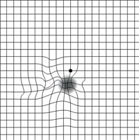 Abnormal Amsler Grid Chart