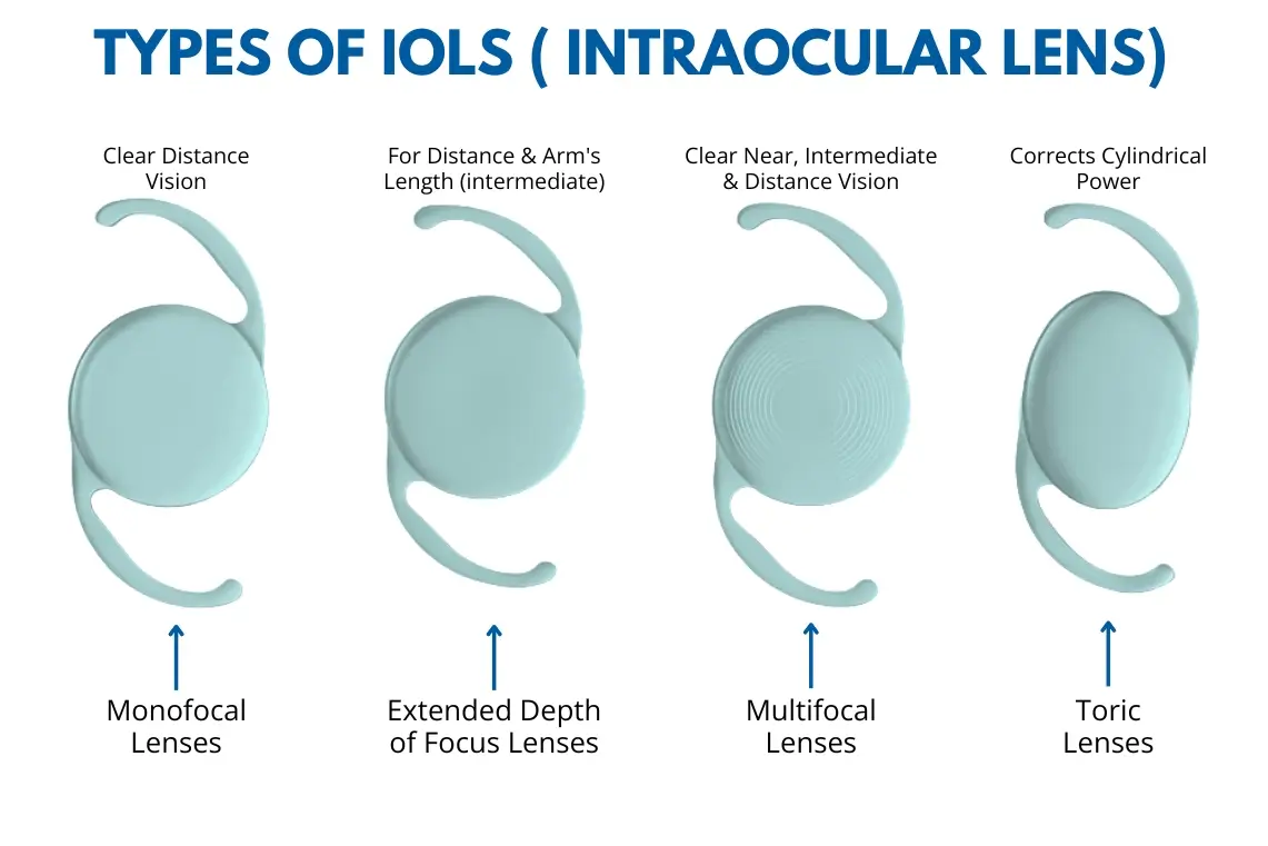 Types of iols cataract lenses