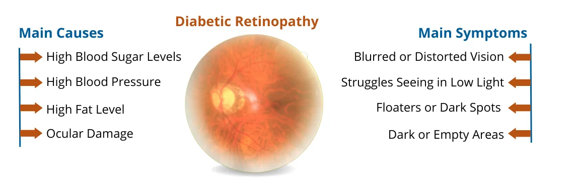 Causes and Symptoms of Diabetic Retinopathy