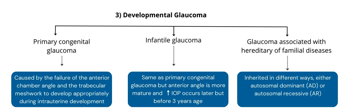 Developmental Glaucoma