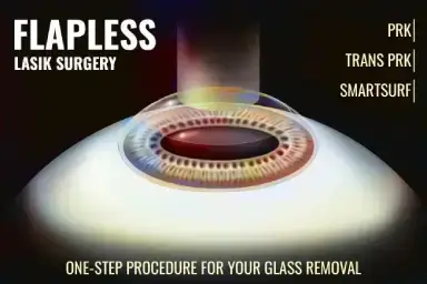 Flapless lasik surgery in delhi