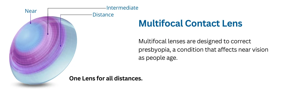 Multifocal Contact Lens