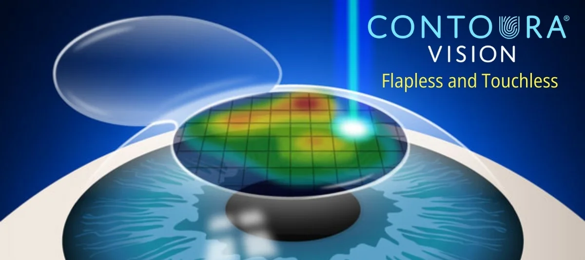 Contoura Vision Surgery