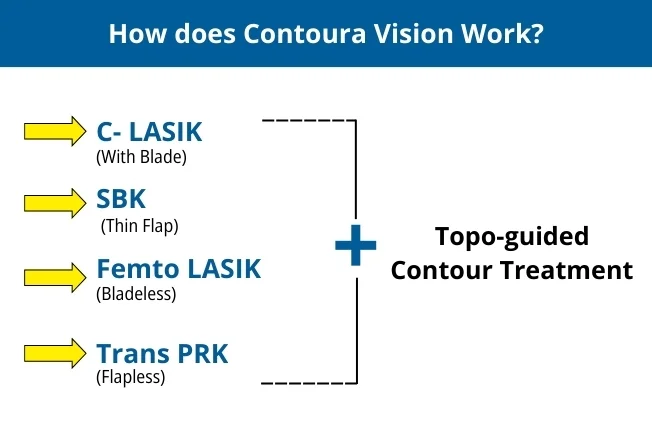 How Does Contoura Vision Work