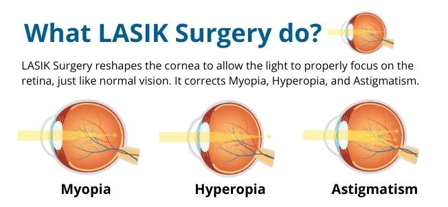What Does Lasik Surgery Corrects