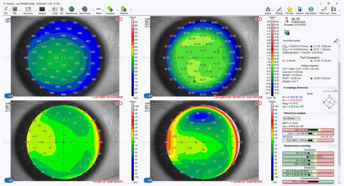 applications-of-sirius-eye-test