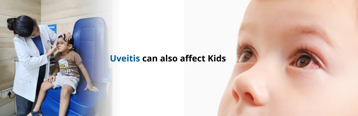 Uveitis in Children