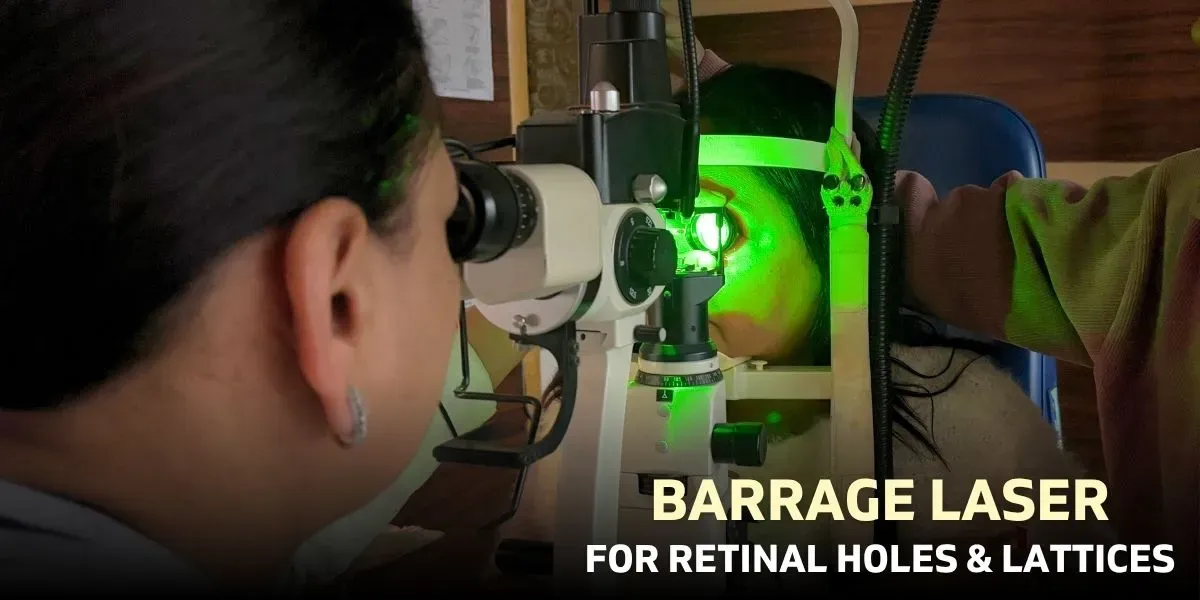 Barrage laser treatment for retinal protection in Delhi