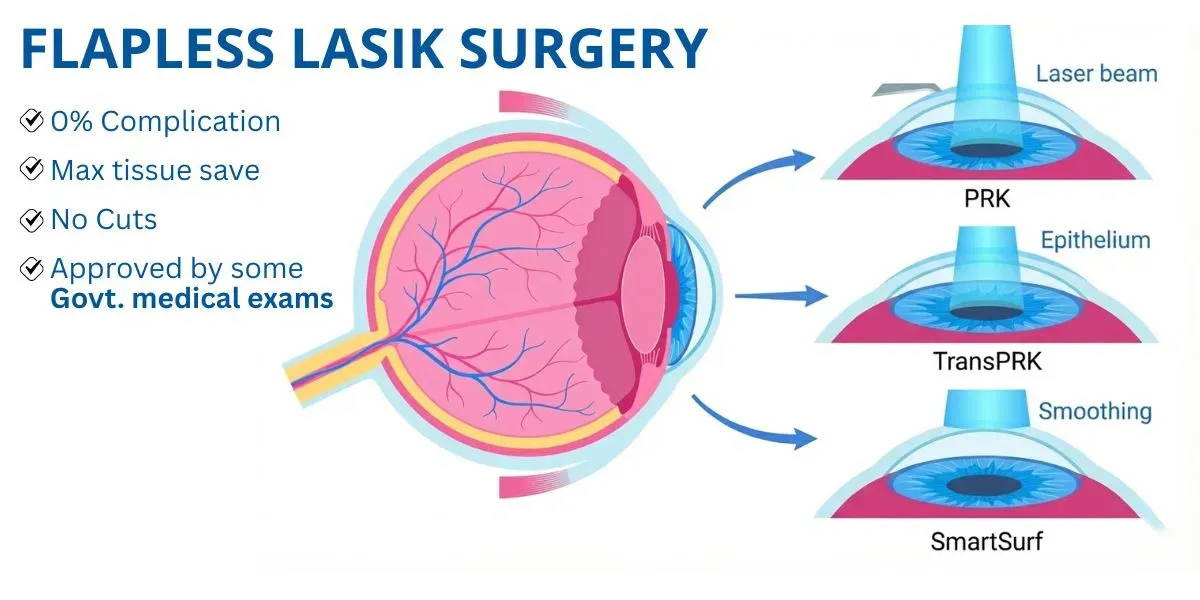 Flapless LASIK surgery in Delhi — PRK, TransPRK and SmartSurf
