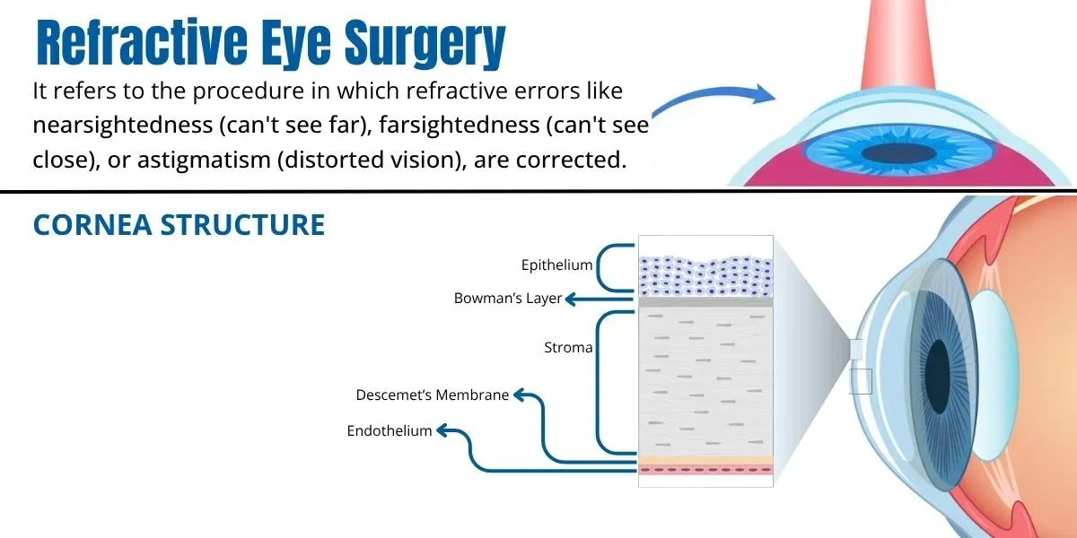 Illustration of refractive eye surgery being evaluated for a patient with a thin cornea