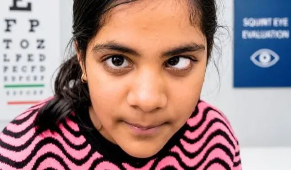 Squint (Strabismus) Treatment