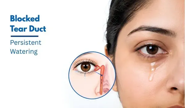 Blocked Tear Duct